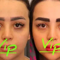 جشنواره طلایی کاشت ابرو،میکرو کاشت حرفه ای و تخصصی