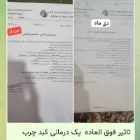 ۴۷٪ مردم بیرجند در خطر کبد چرب|خدمات آرایشگری و زیبایی|بیرجند, |دیوار