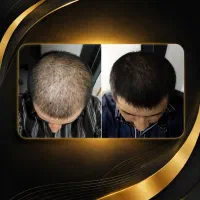 برای همیشه این مشکل حل کن