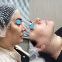 تخفیف تکرارنشدنی ۱۹ شهریور|خدمات آرایشگری و زیبایی|رشت, چله خانه|دیوار