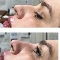 استخدام ادمین کلینیک زیبایی|استخدام هنری و رسانه|یاسوج, |دیوار