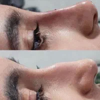 آفر۵۰ درصدی تزریق ژل و بوتاکس ب مدت محدود|خدمات آرایشگری و زیبایی|تهران, نارمک|دیوار