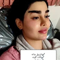 ژل صورت ولب بوتاکس  آنزیم (تخفیف ویژه)