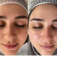 فیشیال تخصصی پوست