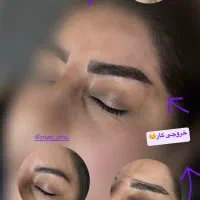 تخفیف ویژه فیبروز ابرو