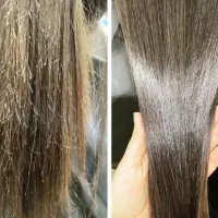 تخفیفات موخوره گیری  روسی فقط ۱۵۰
