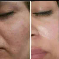 کرم بیوممتیک اورجینال ضدلک و جوانساز