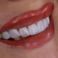 دندان پزشکی/کشیدن دندان/عصب کشی و ترمیم/زیبایی