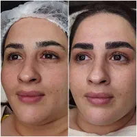 میکروبلیدینگ ابرو فقط ۱ میلیون