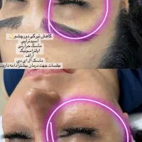 تخفیف ۵۰ ٪فیشیال ( بانوان) آنوبیس  اکلادو  هرموس|خدمات آرایشگری و زیبایی|مشهد, سجاد شهر|دیوار