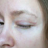 دعوت از مدل به صورت رایگان|خدمات زیبایی و سلامت|تهران, جردن|دیوار