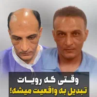 کاشت مو و ابرو و ریش|خدمات آرایشگری و زیبایی|شیراز, قدوسی غربی|دیوار