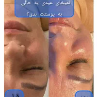 ژل بوتاکس فیلر ،خالبرداری، آموزش فیشیال وپاکسازی|خدمات آرایشگری و زیبایی|شیراز, منطقه هوایی شهید دوران|دیوار