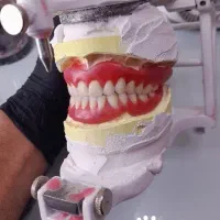 دندانسازی متحرک/دست دندان مصنوعی/BPS