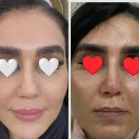 بیومیمتیک ضدلک