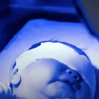 اجاره دستگاه فتوتراپی زردی نوزاد مهتابی|خدمات زیبایی و سلامت|شیراز, بعثت|دیوار