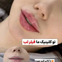 آف تزریق ژل و بوتاکس