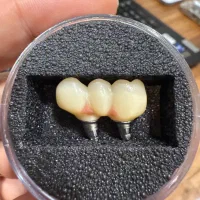 اموزش حضوری دورهای طراحی دیجیتال دندانسازی اگزوکد|خدمات آموزشی|شیراز, زرگری|دیوار