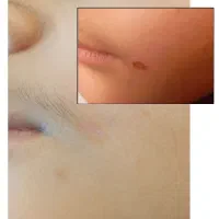 مشکلات پوستی داری راه درمانش و بسپار به ما