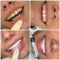 دندانپزشکی قسطی در مطب لنگرود|خدمات آرایشگری و زیبایی|لاهیجان, گلستان|دیوار