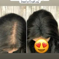 روغن فندق اصل کاژان،برای  بهبودی  ریزش مو ،سکه ای