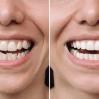 ارتودنسی تخصصی با اقساط بلندمدت بدون سود
