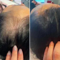 مشکلت حل میشه پیام بده
