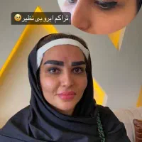 کاشت ابرو دخترانه به روش میکروکاشت