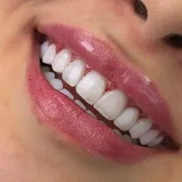 دندانپزشکی،ایمپلنت، اوردنچر|خدمات آرایشگری و زیبایی|مرند, |دیوار