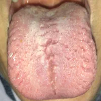 دعوت به فراخوان طب سنتی رایگان