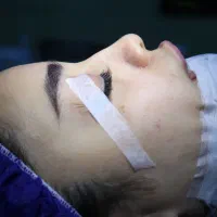 عمل بینی متخصص گوش حلق بینی، اقساطی|خدمات آرایشگری و زیبایی|تهران, قلهک|دیوار