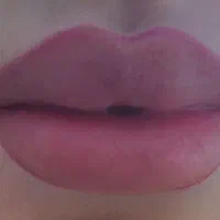 جشنواره ژل و بوتاکس فقط سی سی ۴۰۰