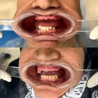 فستیوال اقساطی دندان پزشکی خدمات دندانپزشکی