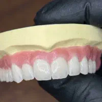 لابراتوار دندانسازی با بهترین متریال