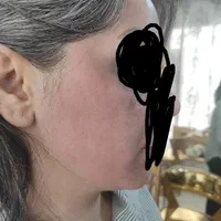 تکنیک مزووایت(روشن کننده پوست) کرمپودر دائم|خدمات آرایشگری و زیبایی|لاهیجان, انقلاب|دیوار