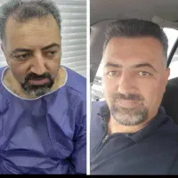 مشاوره کاشت مو،ابرو و کلیه خدمات زیبایی رایگان|خدمات آرایشگری و زیبایی|مشهد, فرهنگ|دیوار