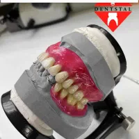 ساخت دندان مصنوعی باضمانت دندانسازی تضمینی