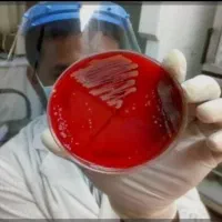 استخدام مسئول فنی (کارشناس آزمایشگاه)