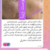 پوست و مو|آرایشی، بهداشتی، درمانی|آستانه اشرفیه, |دیوار