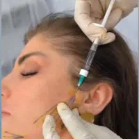 تخفیف ویژه اموزش تزریق بوتاکس و فیلر|خدمات آموزشی|ارومیه, |دیوار