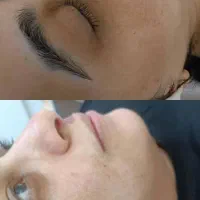 فیشیال و پاک سازی پوست