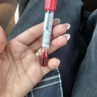 تزریقات و سرم تراپی در منزل|خدمات آرایشگری و زیبایی|پرند, فاز ۰|دیوار