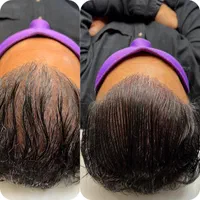 میکرو اسکالپ  و ارایش دائم