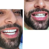 تخفیف خدمات کامپوزیت|خدمات آرایشگری و زیبایی|اهواز, زیتون کارمندی|دیوار