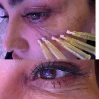 تزریق ژل سی سی 600|خدمات آرایشگری و زیبایی|پیشوا, |دیوار