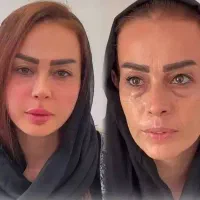 آف ویژه فیلر فول فسی  و مدلینگ صورت فقط ۳۹۰۰|خدمات آرایشگری و زیبایی|کرج, گوهردشت|دیوار