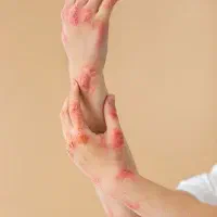 خودایمنی پسو|آرایشی، بهداشتی، درمانی|چالدران, |دیوار