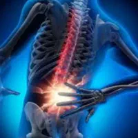 درمان کمر درد و گرفتگی و اسپاسم کمر|آرایشی، بهداشتی، درمانی|بندرعباس, |دیوار