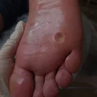 پودولوژی در ساری