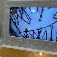 کراتین و اسکراب اسکالپ|خدمات آرایشگری و زیبایی|گرگان, |دیوار